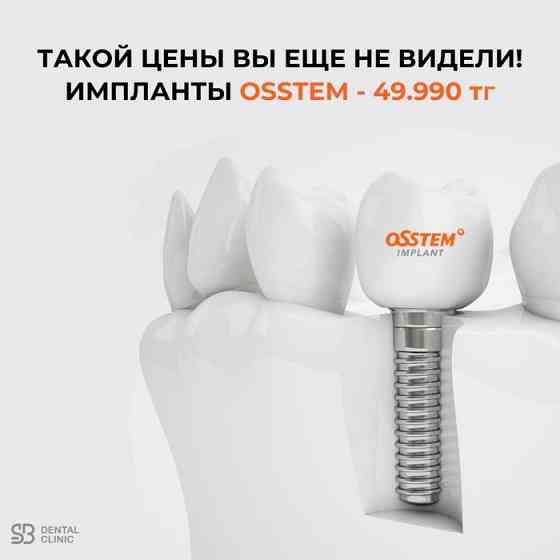 Зубные импланты Стоматология Алматы