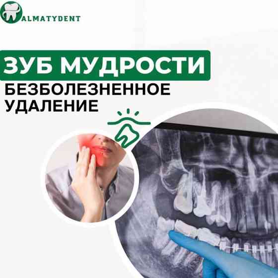 Каспи Ред. Импланты. Акция в стоматологии Алматы